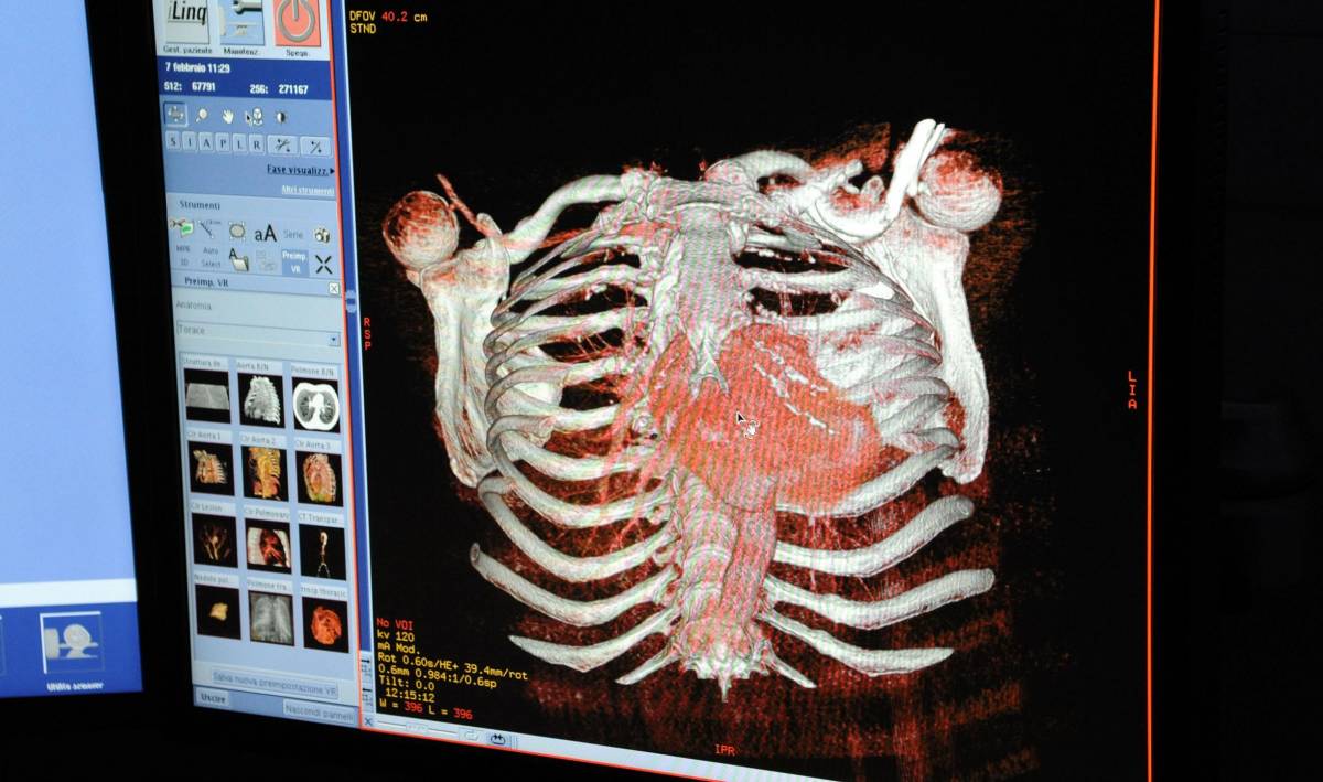 Sanità: una Tac all’avanguardia ma la Regione non la sfrutta