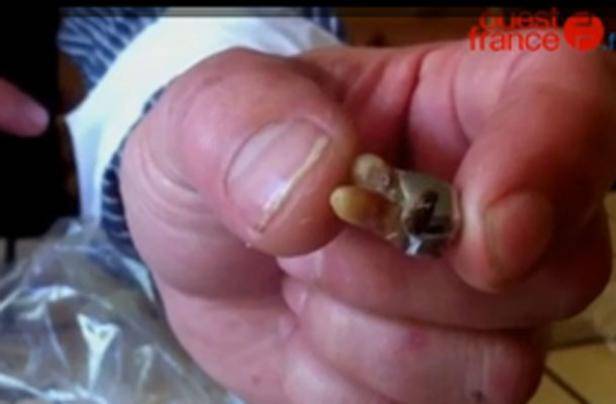 Pranzo con sorpresa per una coppia francese 
Nella carne di una salsiccia c'è un dente umano