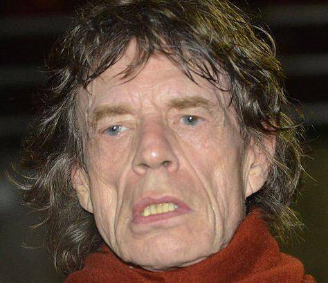 Muto per lo shock Paura per la salute di Mick Jagger