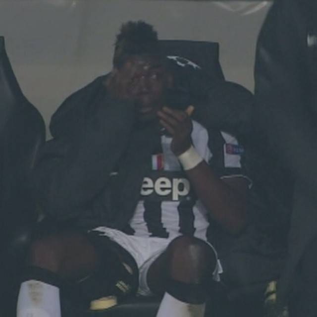 Nella notte magica di Dortmund Pogba si fa male e piange - il Giornale