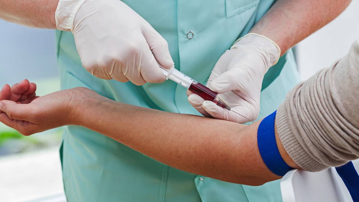 L'esame del sangue  ora predice l'infarto