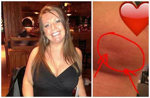Ha un tumore al seno e pubblica la foto su Facebook: lo scatto diventa virale