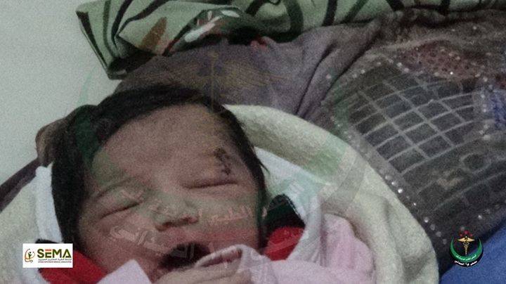 Amal, la bambina siriana nata con uno shrapnel in testa