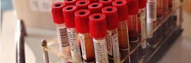 Un test per scoprire il cancro «Bastano» le analisi del sangue