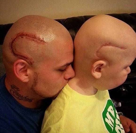"Questa cicatrice non renderà un incubo la vita di mio figlio"