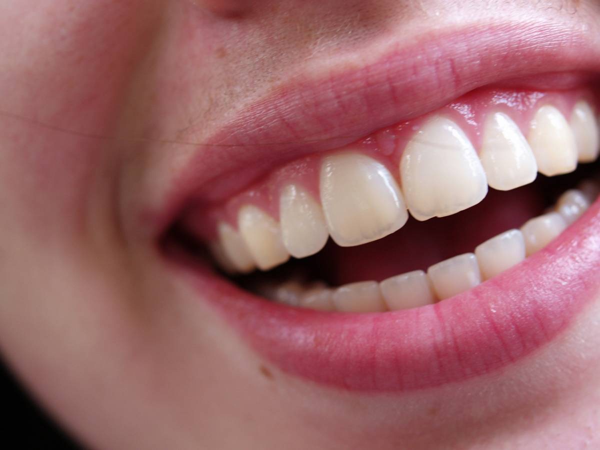 L'allarme degli esperti sui denti: perderli riduce aspettativa di vita