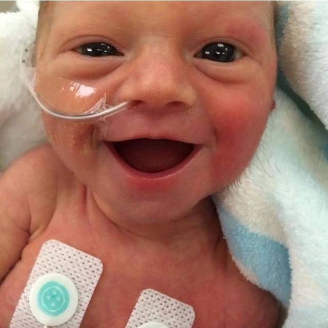 La foto di questa bimba nata prematura è diventata virale: "Lei è felice"  