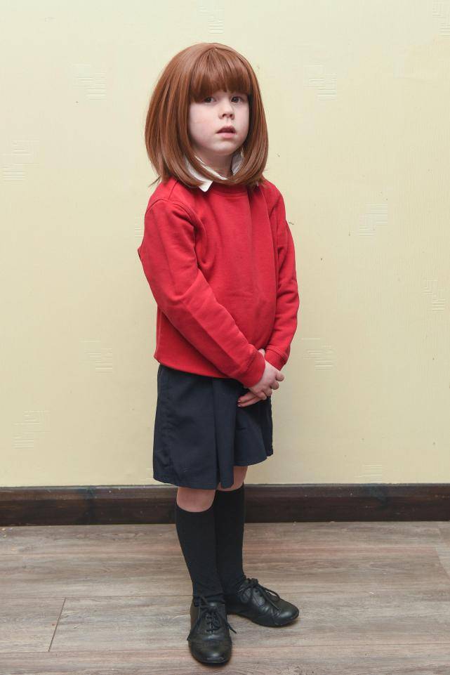 Bimba soffre di alopecia e i bulli la deridono: scuola vieta la parrucca