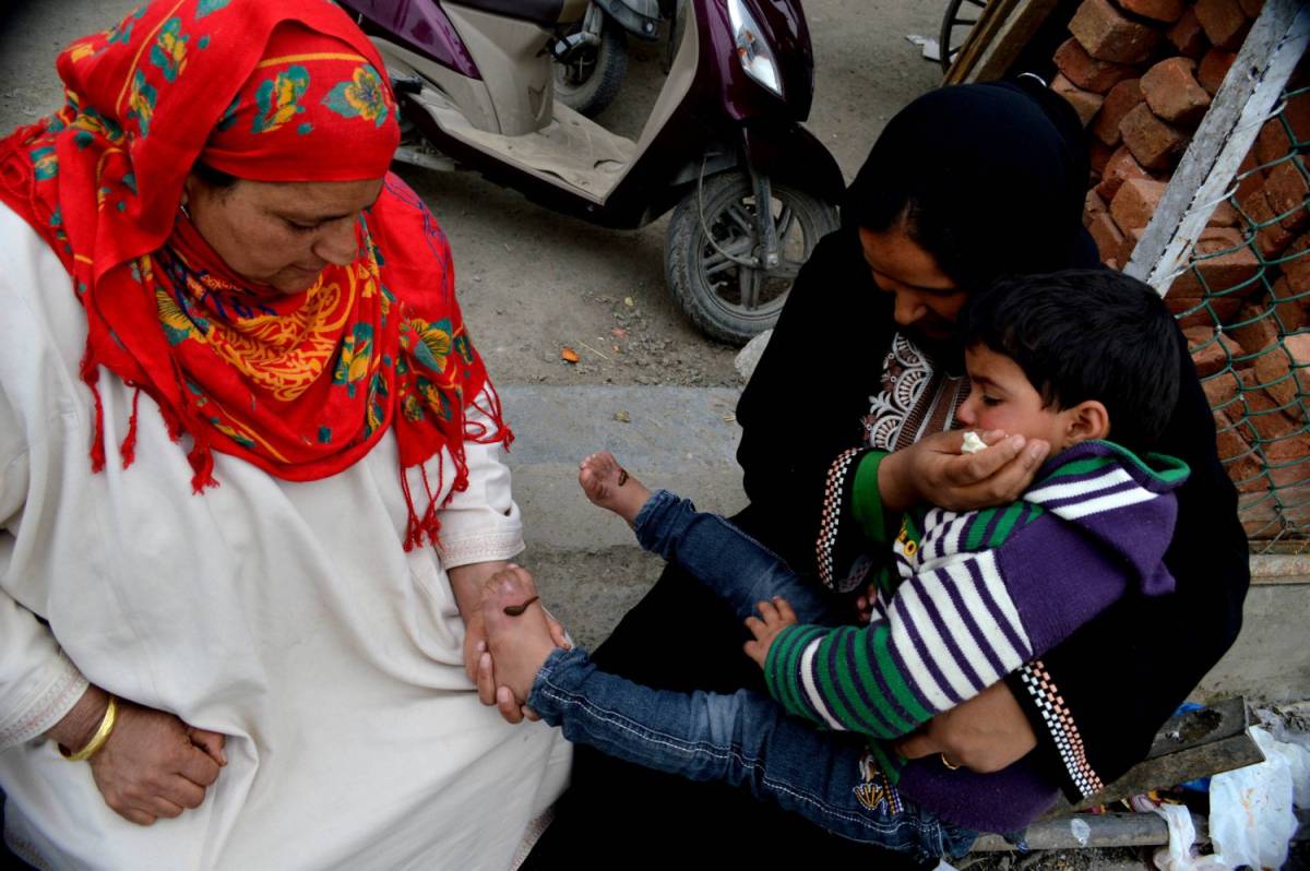 La cura choc del Kashmir: quei guaritori tradizionali ​che usano le sanguisughe