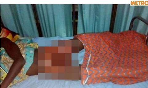Nigeria, genitori danno fuoco ai genitali del presunto stupratore della figlia