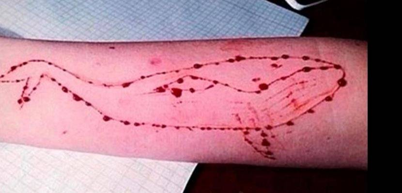 Pescara, 15enne con segni sul braccio: "Caso Blue Whale"