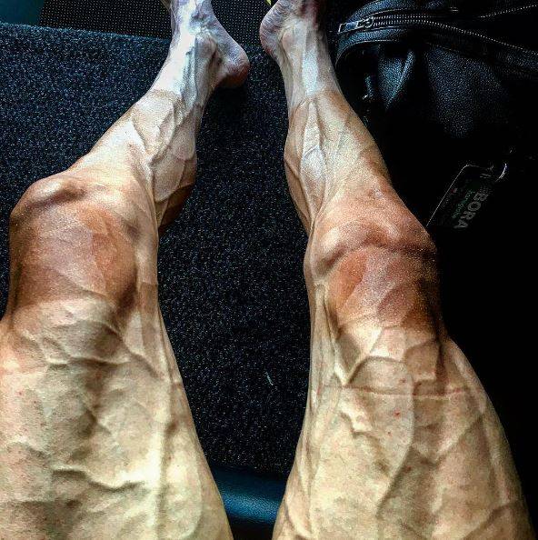 Tour de France, la sconvolgente foto delle gambe di Poljanski 