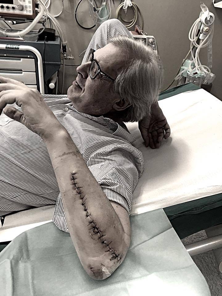 Sgarbi e la cicatrice al braccio: la foto che preoccupa i fan