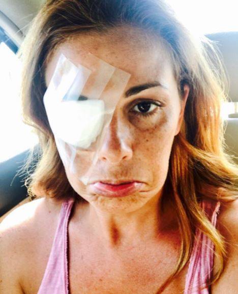 Vanessa Incontrada ferita su Instagram: "Un trucco mi ha fatto allergia"