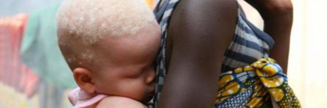 Mozambico, bambino albino ucciso e mutilato: rubato il cervello