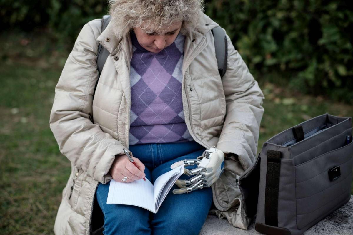 Almerina, la prima donna italiana con mano bionica sensibile al tatto