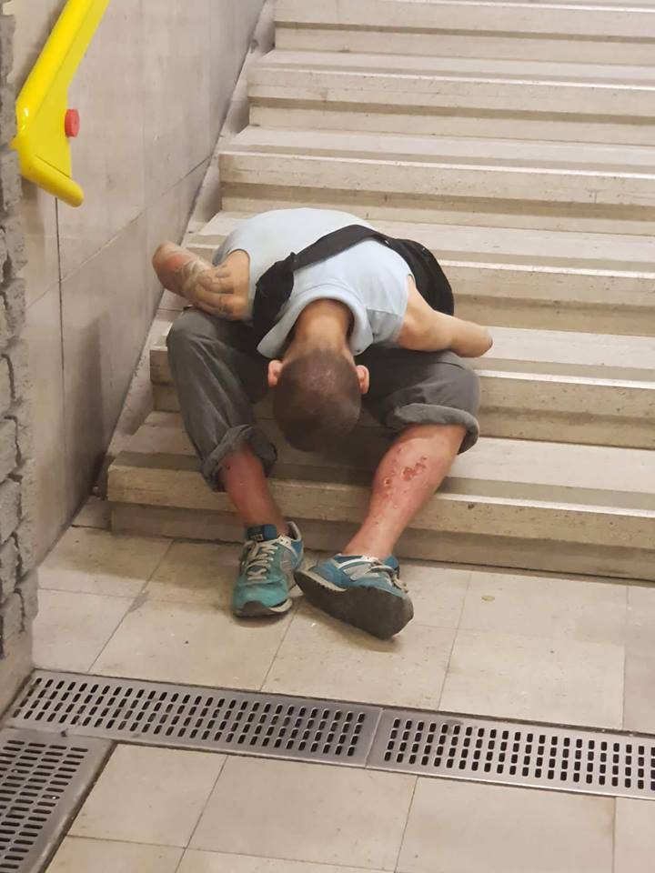 Milano, degrado choc in metro: gambe maciullate dalla droga