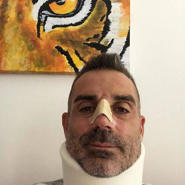 Juventus, CR7 manda all'ospedale Sorrentino che ironizza: "Mi ha preso in pieno"