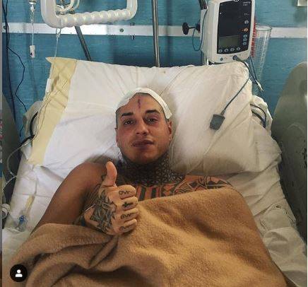 Francesco Chiofalo dopo l'intervento torna su Instagram: "Ce l'ho fatta, sto bene"