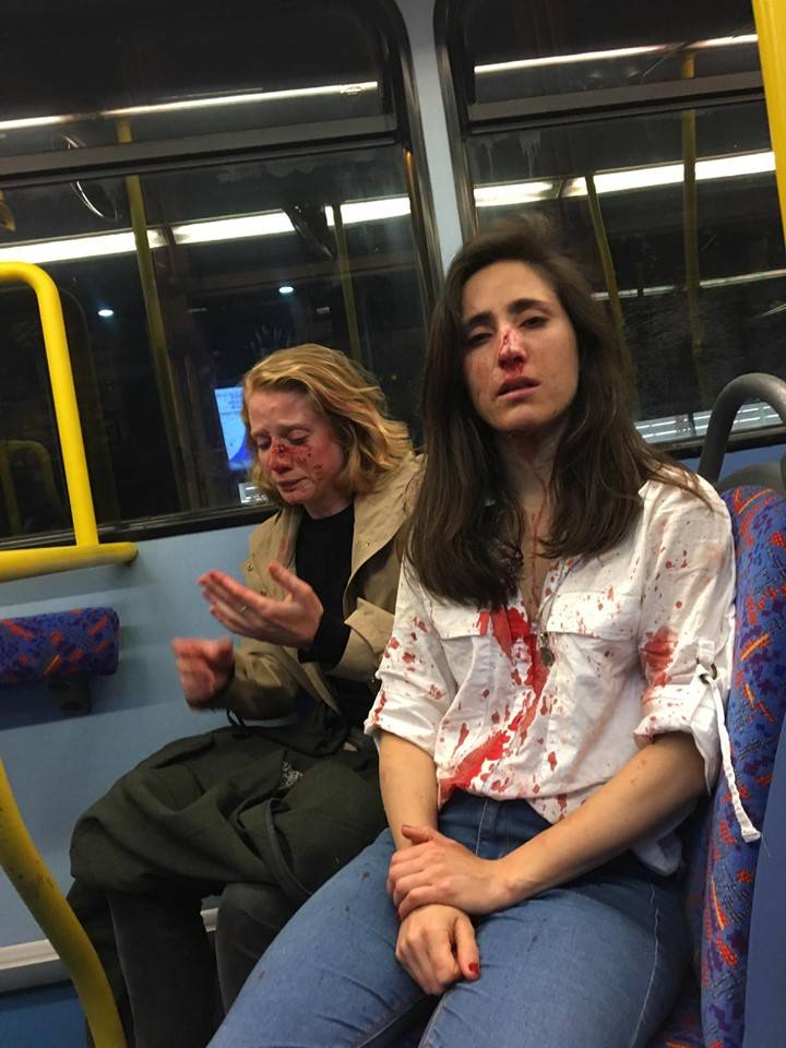 Londra, coppia lesbica aggredita sul bus: "Volevano che ci baciassimo"