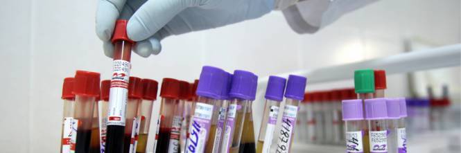 Storia choc della ricercatrice: "Ho preso l'Hiv in laboratorio"