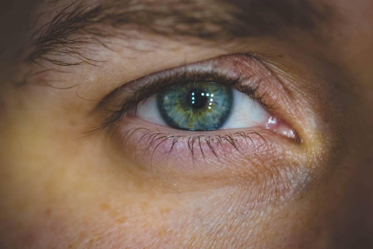 Morbo di Alzheimer: nuova diagnosi a base di scansione oculare