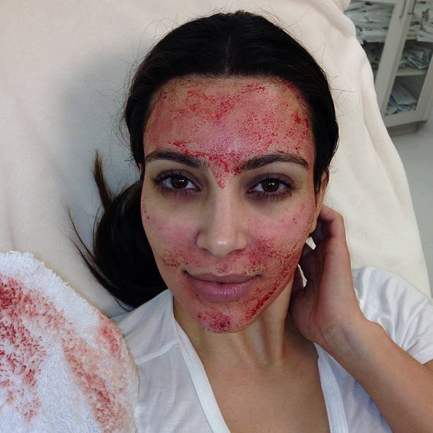 Kim Kardashian: "Non fate questo trattamento"