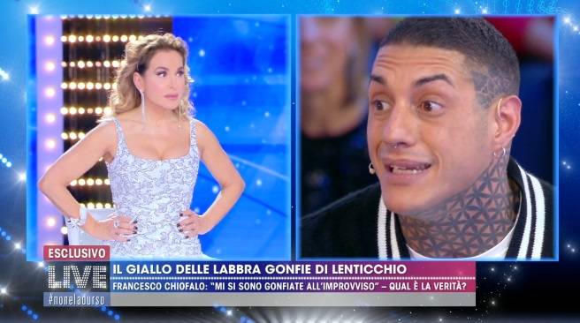 Francesco Chiofalo: "Le labbra gonfie per un'allergia, ma pensano sia rifatto perché sono bello"
