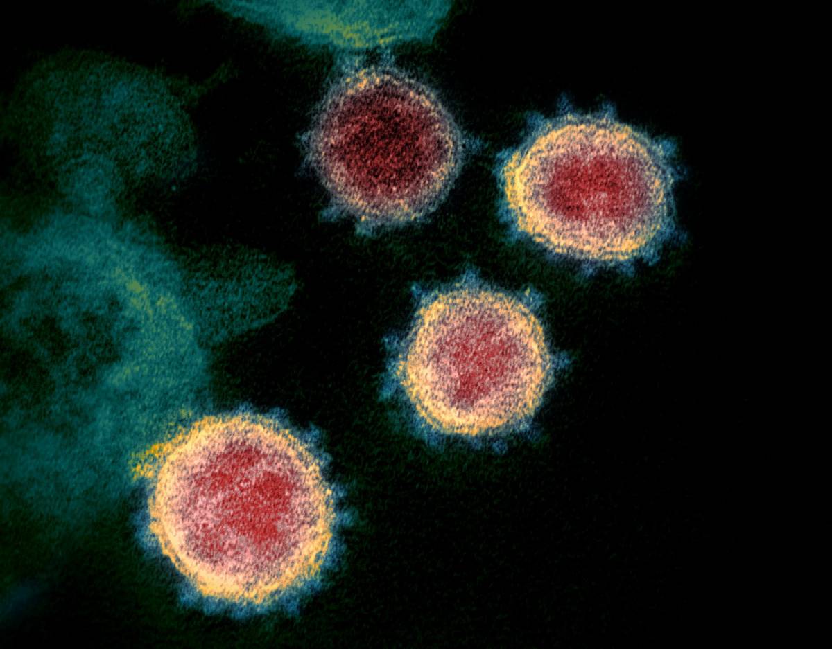 Il coronavirus non è stato creato in laboratorio: ecco la prova