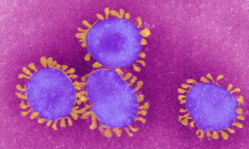 Ora si testa un nuovo farmaco: "Può sconfiggere il coronavirus"