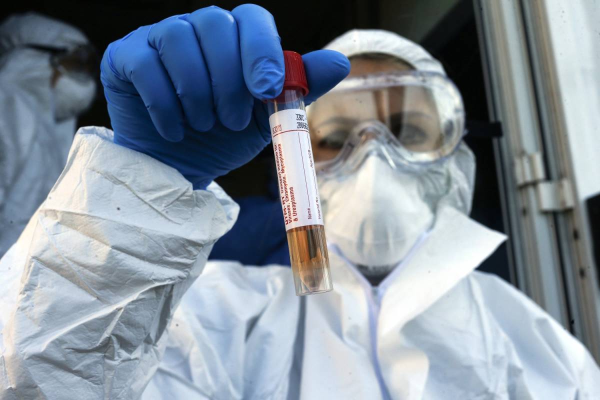 Coronavirus, pronti laboratori privati per effettuare test sugli anticorpi