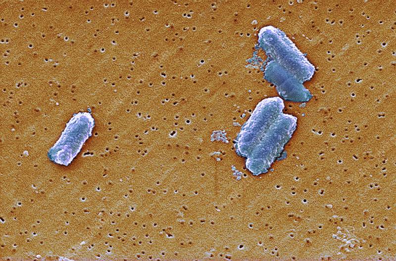 Citrobacter, come si manifesta il batterio che uccide un bimbo su tre