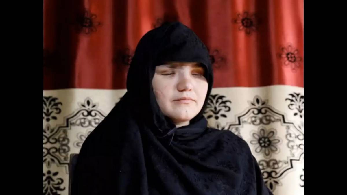 33enne accecata dai Talebani perché aveva "deciso di lavorare"