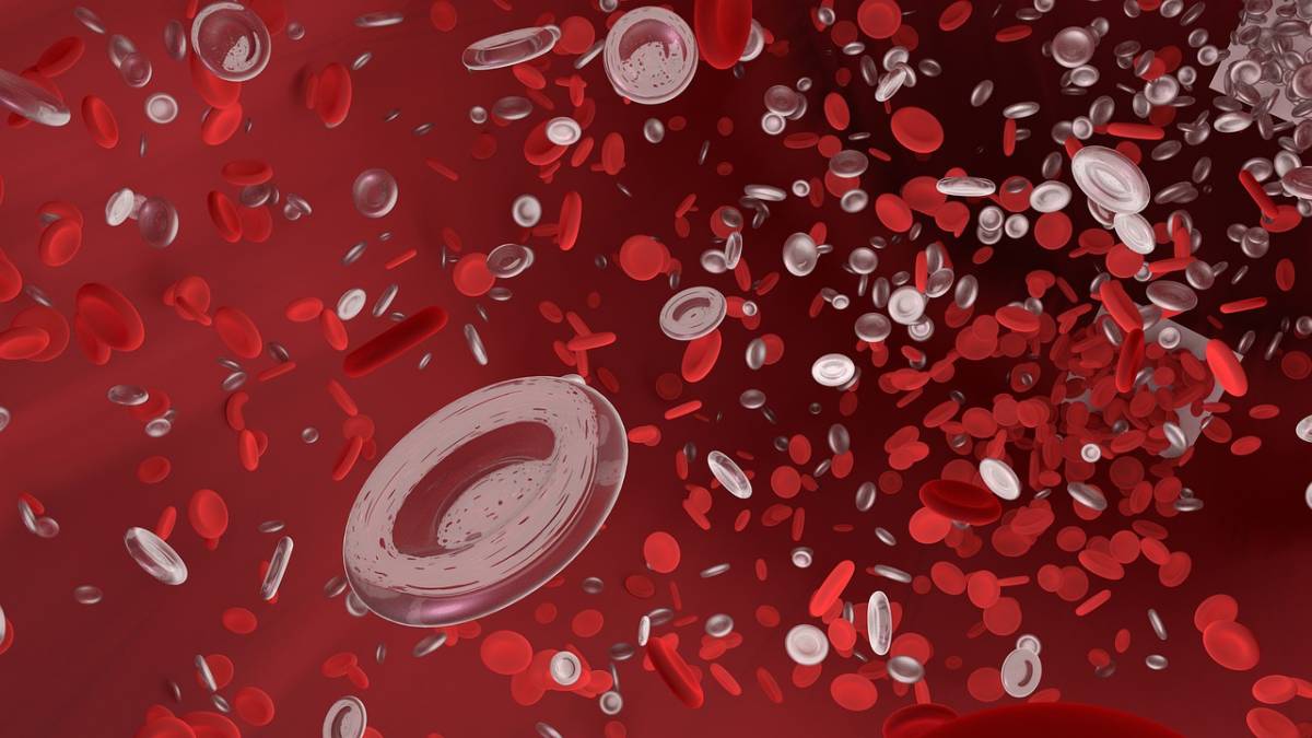 L'anemia falciforme è associata a forme gravi di Covid