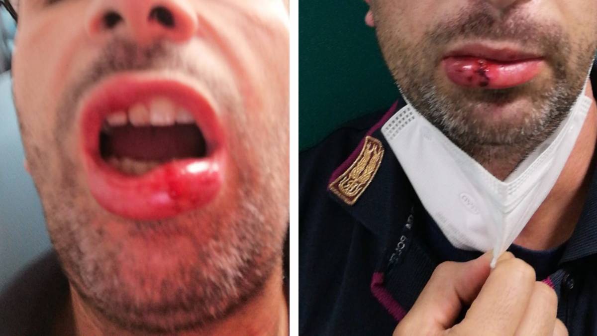 "Che c... mi controllate a fare?". Poi la violenza sull'agente