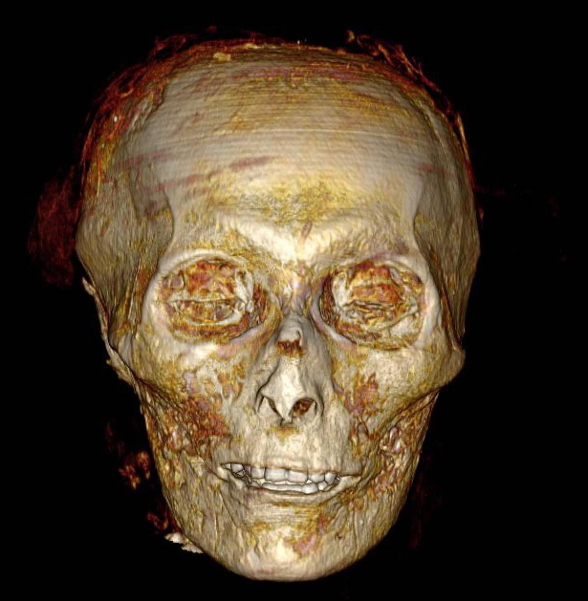 Svelata (con una Tac) dopo 3.500 anni la mummia del faraone più glamour