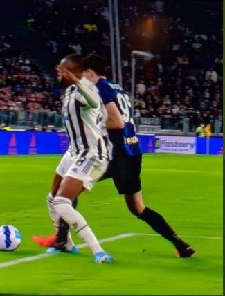 Cosa è successo con lo "step on foot" in Juve-Inter