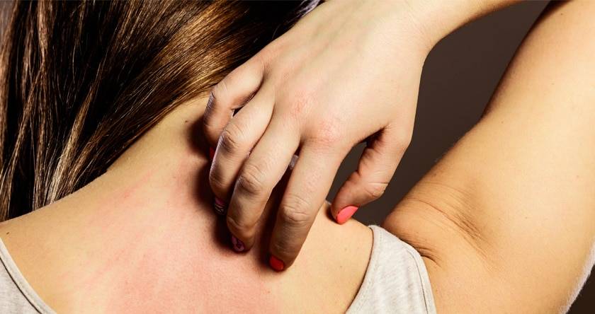 Differenze tra eczema e orticaria 