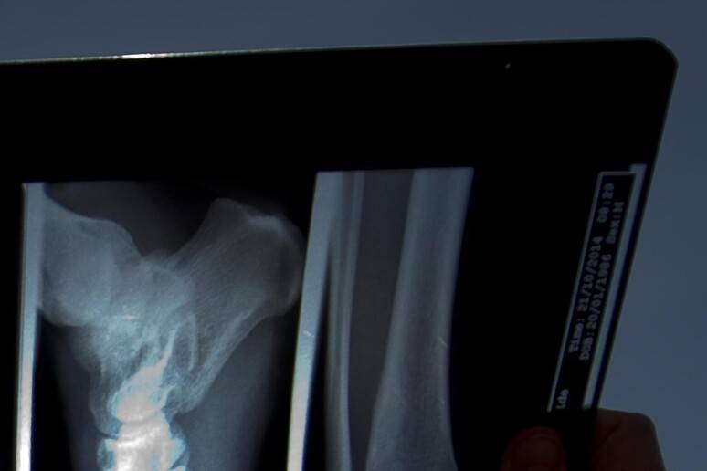 Costrette a spogliarsi e fotografate di nascosto: la violenza del radiologo a Varese
