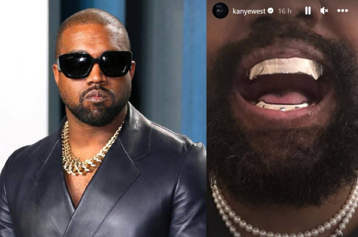 "Protesi di titanio al posto dei denti". L'ultima follia di Kanye West