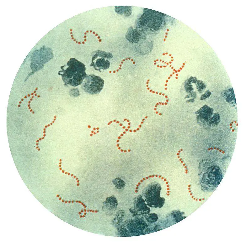 Das ist der Anfang vom Ende - Pagina 12 1711292930-streptococcus-pyogenes