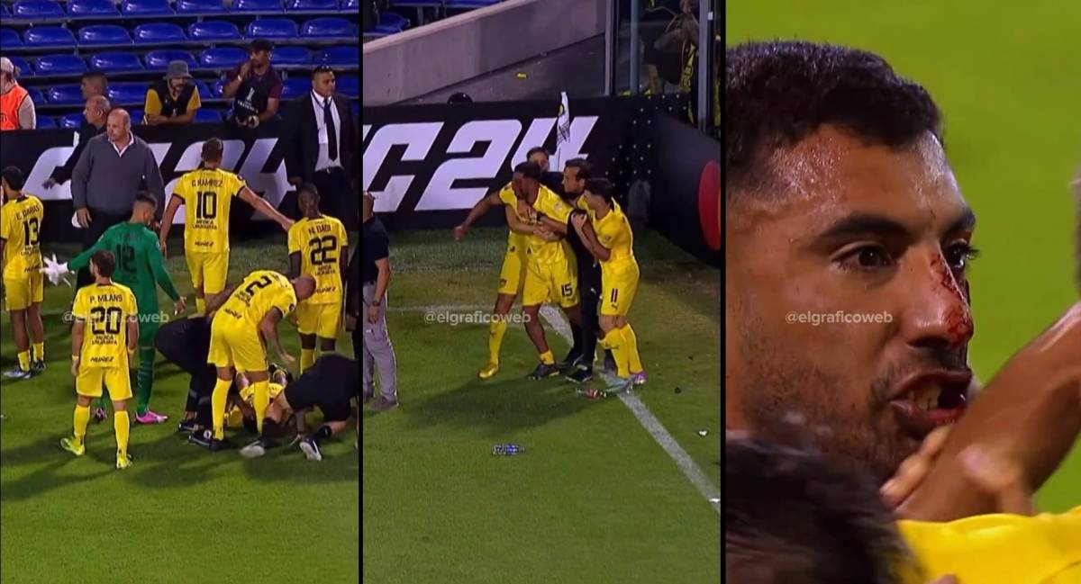  Choc durante la partita: l'ex della Fiorentina colpito al volto con una pietra - VIDEO