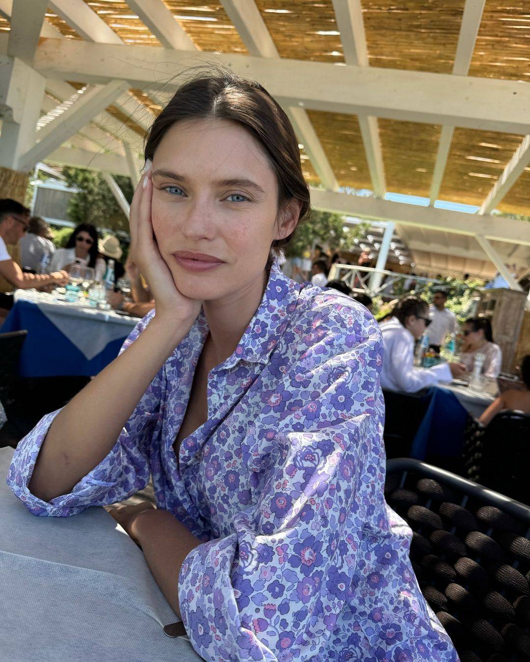 Dopo l'operazione, la chemioterapia: continua la battaglia di Bianca Balti contro il tumore