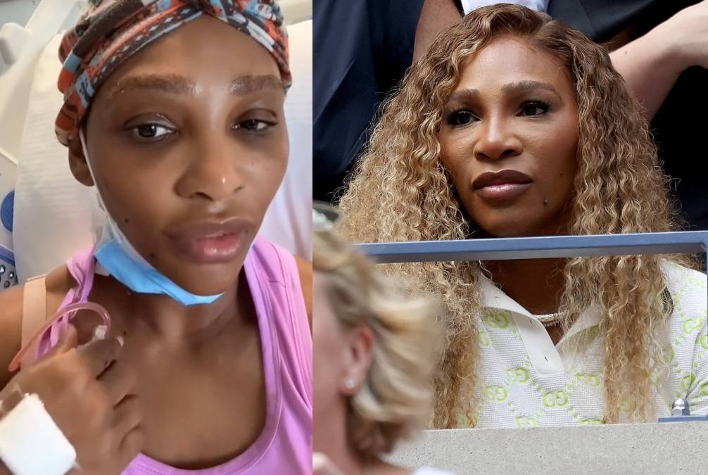 Serena Williams, il dramma sui social: "Operata per una cisti branchiale grande come un pompelmo"