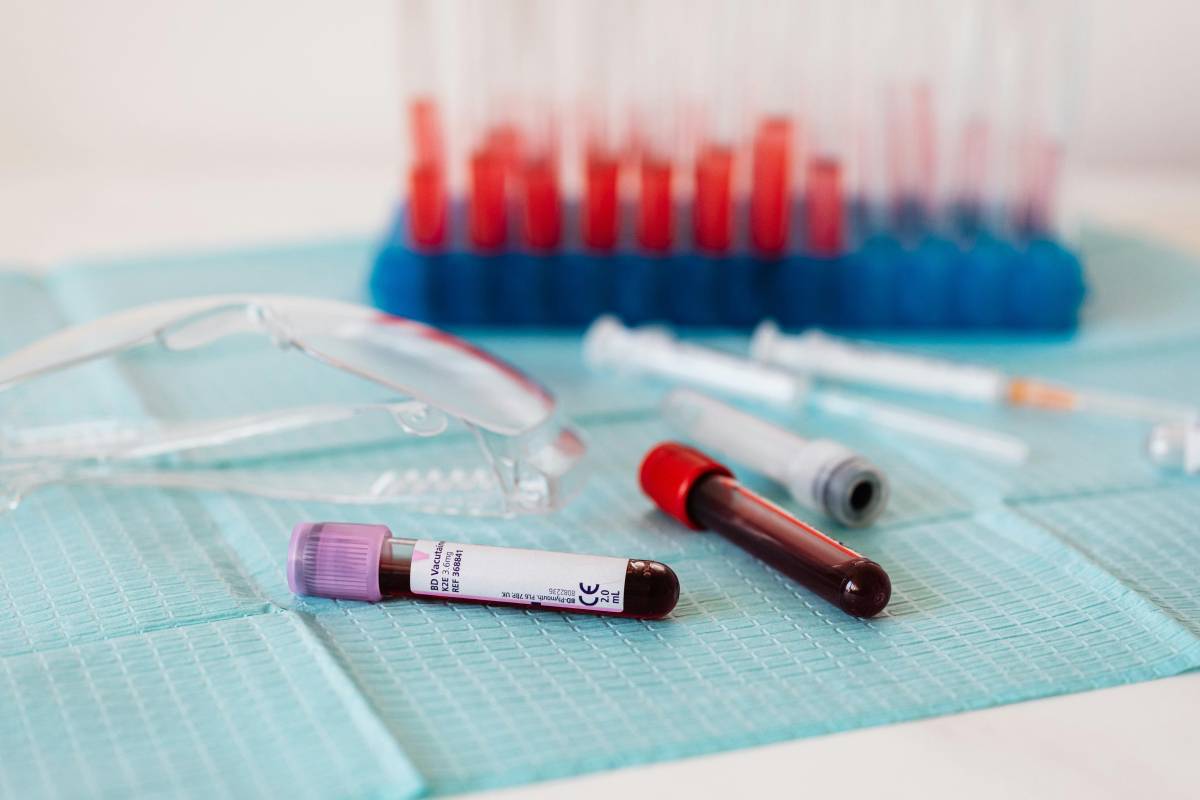 Malattie cardiovascolari: il nuovo esame del sangue che ne prevede il rischio