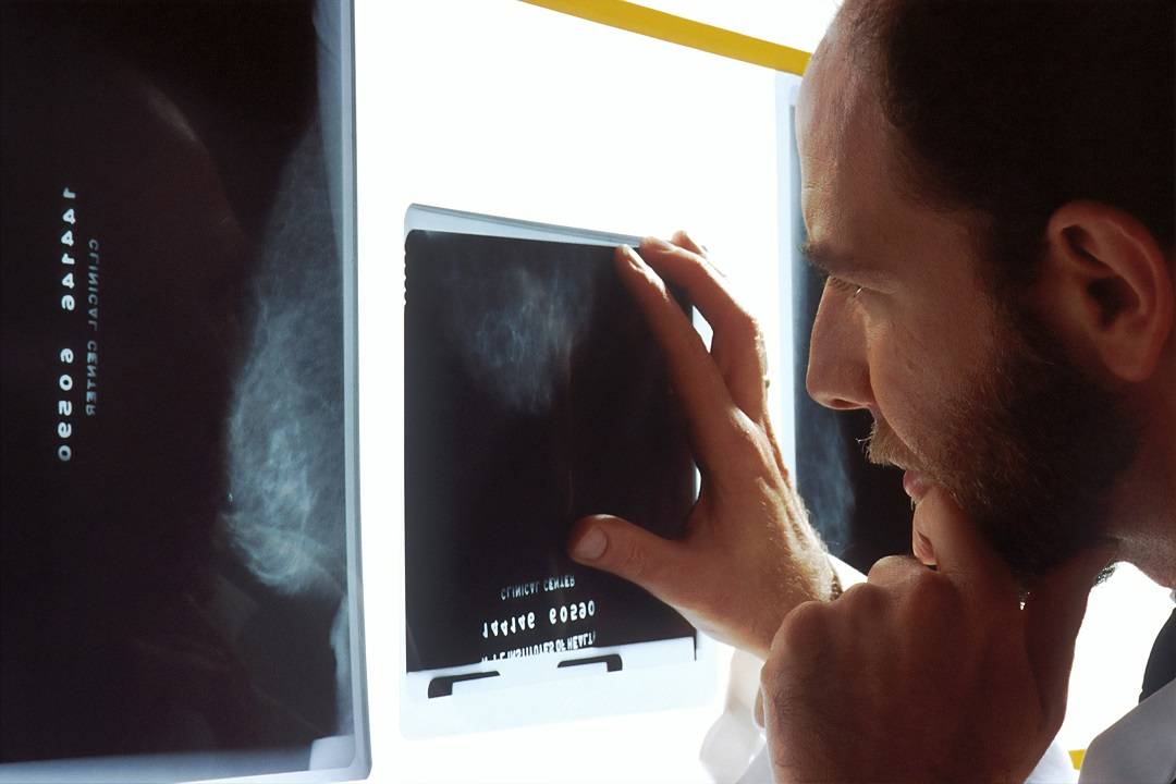 Mammografie gratuite per donne tra i 40 e i 49 anni. Prenotazioni il 31 maggio a Catania con “Maggio in…forma”