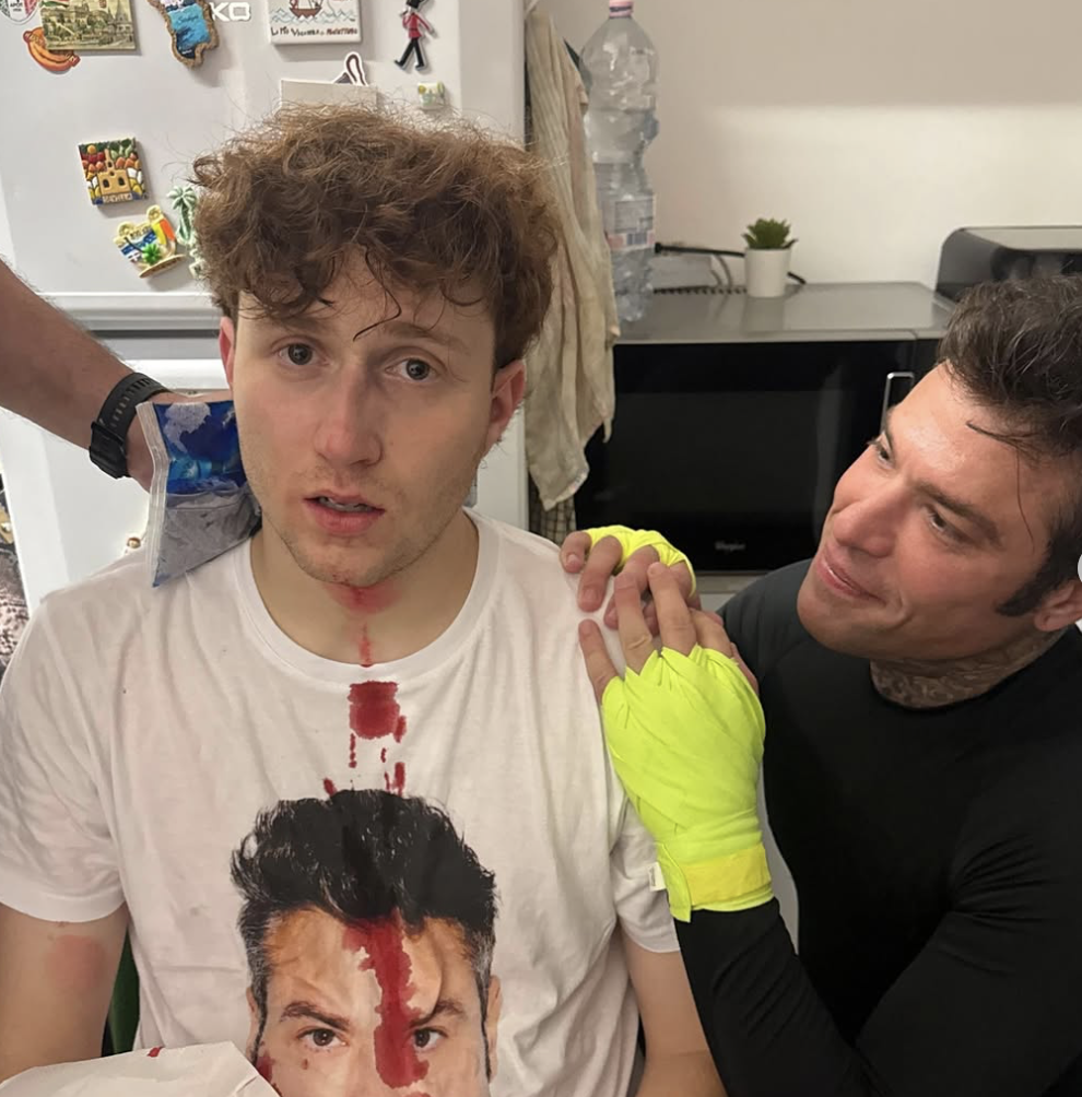 Fedez rompe il naso al Rosso in diretta, la corsa in ospedale: cosa è successo