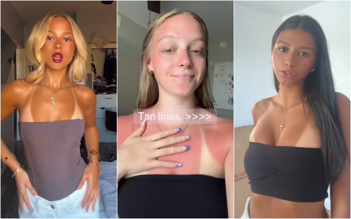 Attenti a questo trend: l'ultima folle sfida dei social che può costare cara alla pelle