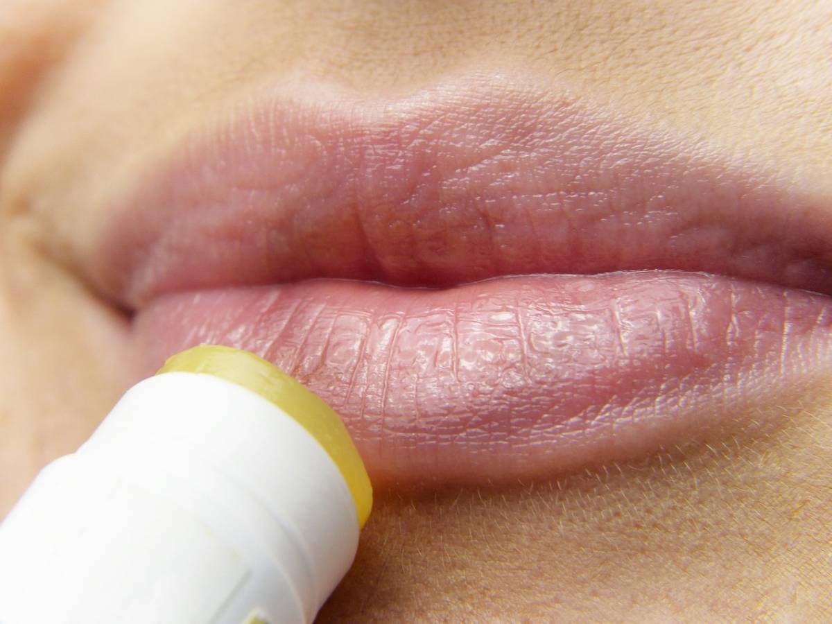 Labbra screpolate d'estate, come renderle morbide. 4 soluzioni da portare anche in vacanza