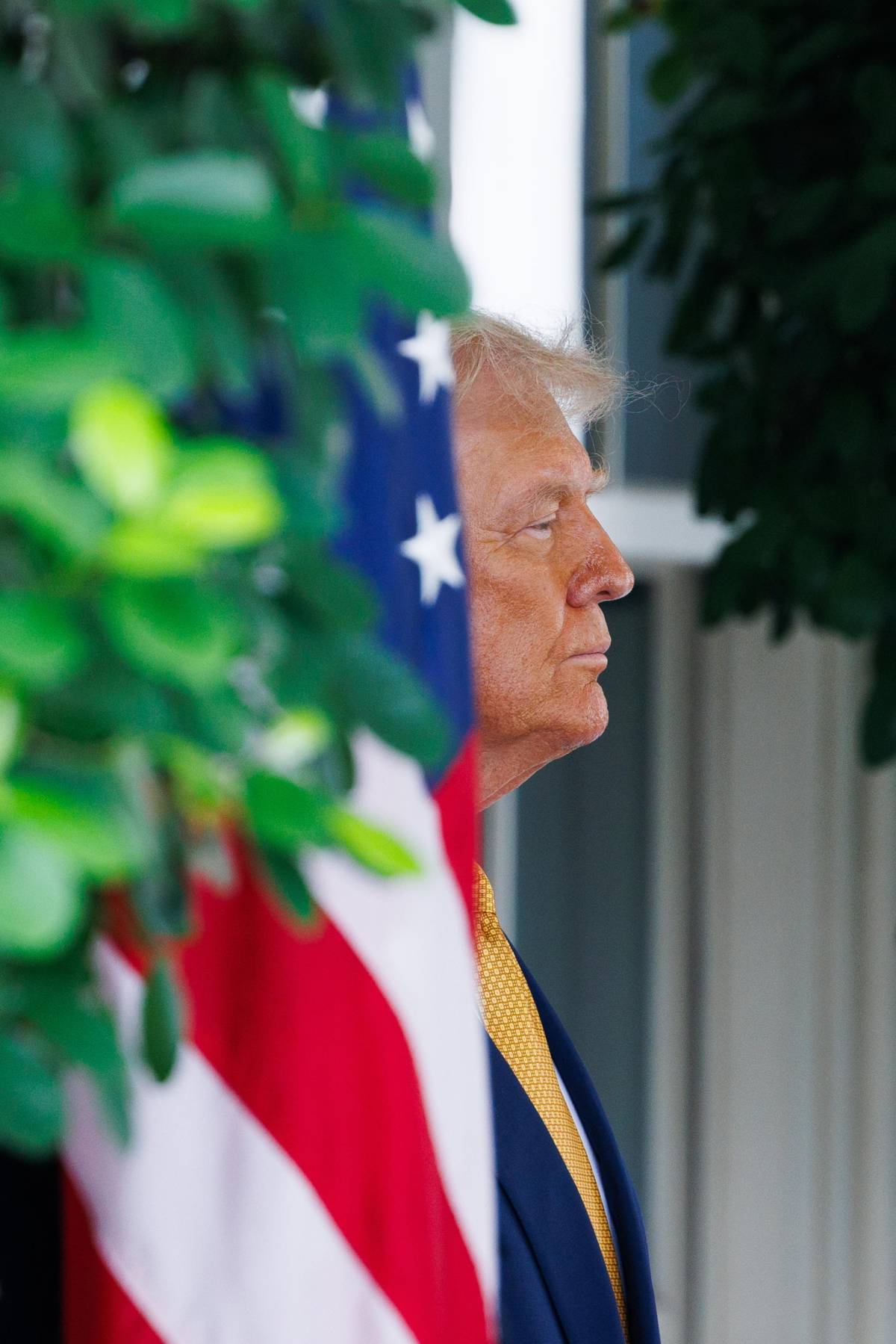 "Insufficienza venosa cronica": come sta davvero Donald Trump